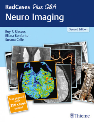 Książka RadCases Plus Q&A Neuro Imaging Roy Riascos