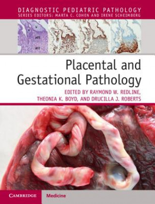 Kniha Placental and Gestational Pathology Hardback with Online Resource Raymond Redline