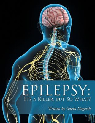 Könyv Epilepsy GAVIN HOGARTH