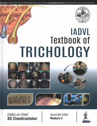 Kniha IADVL Textbook of Trichology BS Chandrashekar
