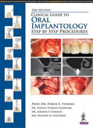 Könyv Clinical Guide to Oral Implantology Porus S Turner