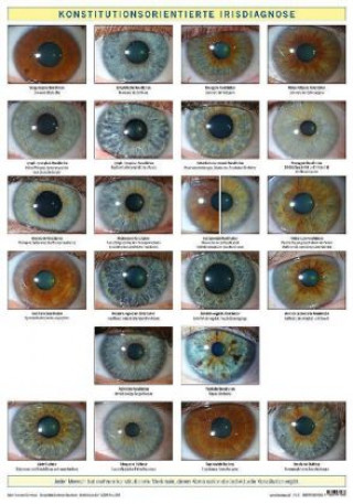 Tiskovina Konstitutionsorientierte Irisdiagnose, Wandtafel Friedemann Garvelmann