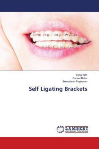 Knjiga Self Ligating Brackets Sonal Attri