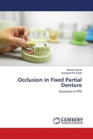 Knjiga Occlusion in Fixed Partial Denture Manish Kumar