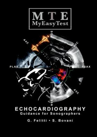 Książka Echocardiography - MyEasyTest GIUSEPPE FELITTI