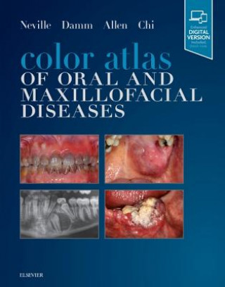 Книга Color Atlas of Oral and Maxillofacial Diseases Neville