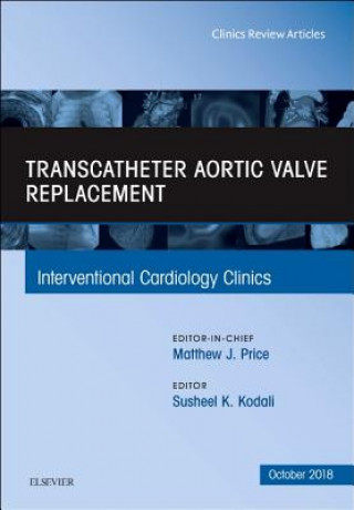 Könyv Transcatheter Aortic Valve Replacement, An Issue of Interventional Cardiology Clinics Kodali
