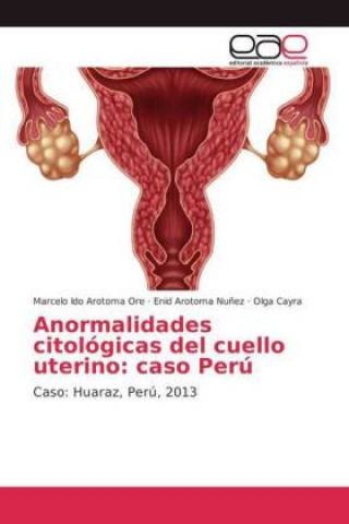 Carte Anormalidades citologicas del cuello uterino Marcelo Ido Arotoma Ore