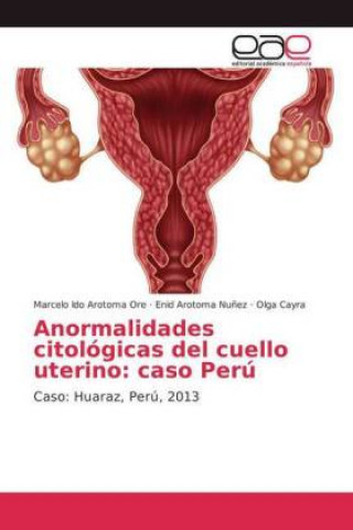 Book Anormalidades citologicas del cuello uterino Marcelo Ido Arotoma Ore