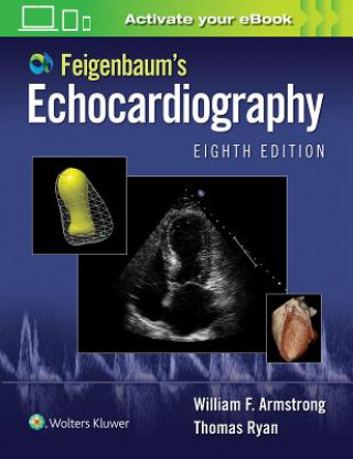 Kniha Feigenbaum's Echocardiography William F. Armstrong