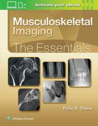 Kniha Musculoskeletal Imaging: The Essentials Felix S. Chew
