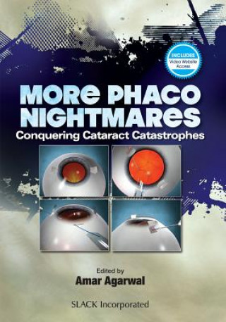 Libro More Phaco Nightmares Amar Agarwal