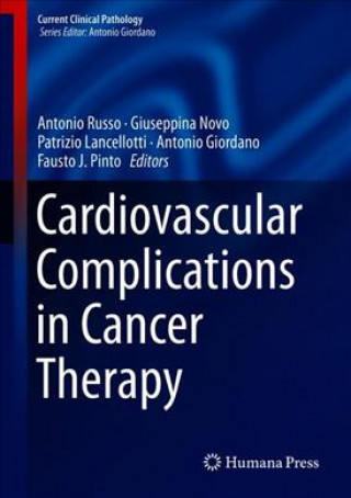 Kniha Cardiovascular Complications in Cancer Therapy Antonio Russo