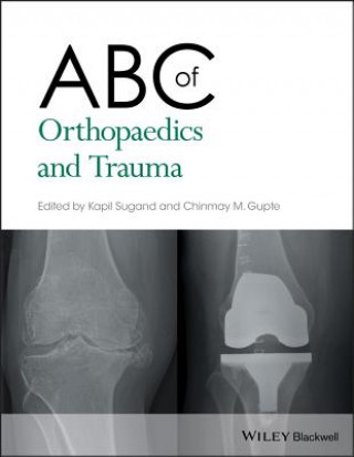 Carte ABC of Orthopaedics and Trauma Kapil Sugand