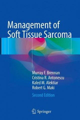 Kniha Management of Soft Tissue Sarcoma MURRAY F. BRENNAN