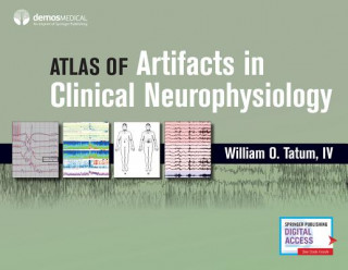 Könyv Artifacts in Clinical Neurophysiology Tatum