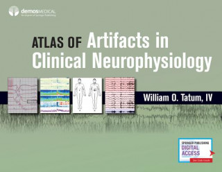 Книга Artifacts in Clinical Neurophysiology Tatum