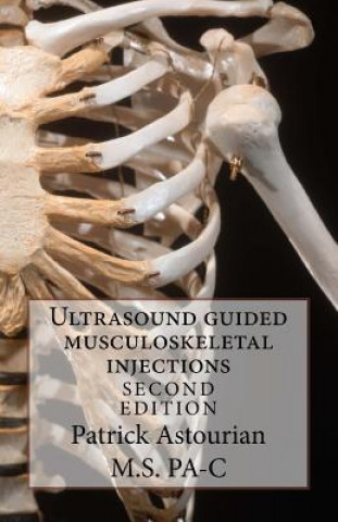 Könyv Ultrasound Guided Musculoskeletal Injections Patrick Astourian