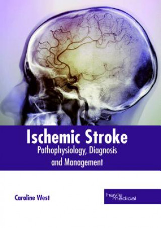 Könyv Ischemic Stroke: Pathophysiology, Diagnosis and Management CAROLINE WEST