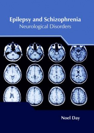 Kniha Epilepsy and Schizophrenia: Neurological Disorders NOEL DAY