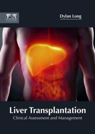 Könyv Liver Transplantation: Clinical Assessment and Management DYLAN LONG