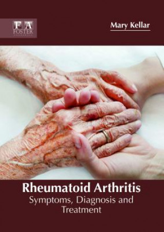 Kniha Rheumatoid Arthritis: Symptoms, Diagnosis and Treatment MARY KELLAR