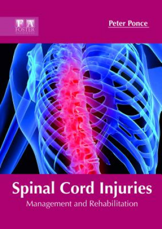 Kniha Spinal Cord Injuries: Management and Rehabilitation PETER PONCE