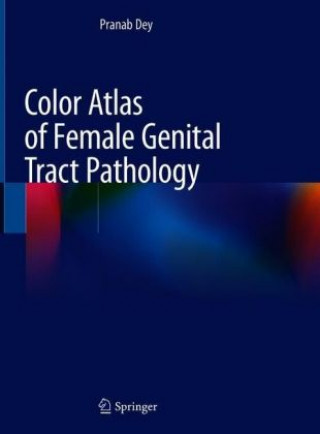 Carte Color Atlas of Female Genital Tract Pathology Pranab Dey