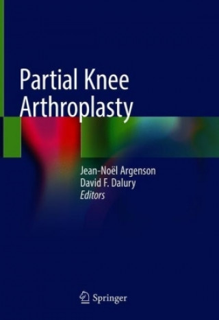 Kniha Partial Knee Arthroplasty Jean-Noël A. Argenson