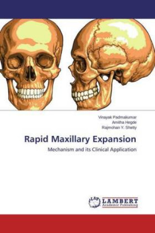 Książka Rapid Maxillary Expansion Vinayak Padmakumar