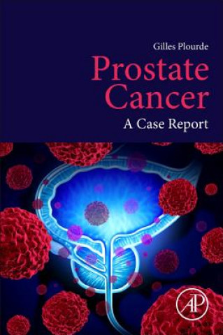 Carte Prostate Cancer Plourde