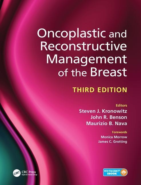 Kniha Oncoplastic and Reconstructive Management of the Breast, Third Edition Steven J. Kronowitz MD Facs