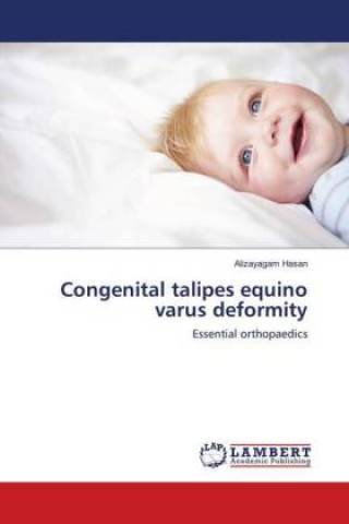 Buch Congenital talipes equino varus deformity Alizayagam Hasan