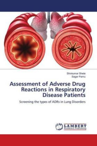 Könyv Assessment of Adverse Drug Reactions in Respiratory Disease Patients Shivkumar Shete