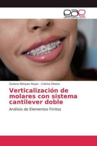 Carte Verticalizacion de molares con sistema cantilever doble Giuliana Márquez Reyes