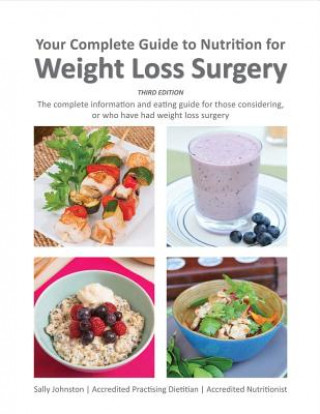 Könyv Your Complete Guide to Nutrition for Weight Loss Surgery, Volume 1 Sally Johnston