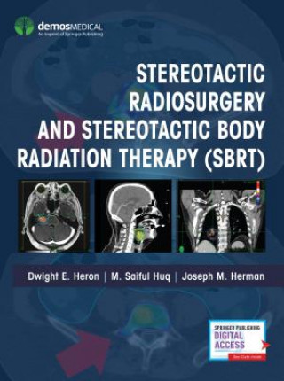 Kniha Stereotactic Radiosurgery and Stereotactic Body Radiation Therapy (SBRT) Joseph M. Herman