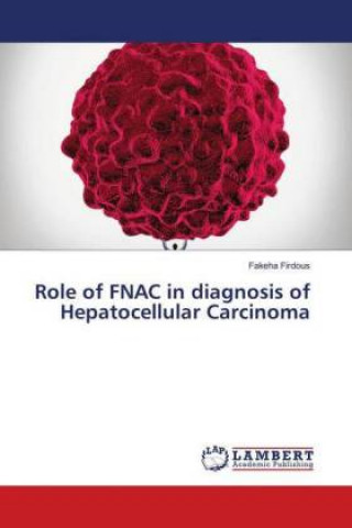 Kniha Role of FNAC in diagnosis of Hepatocellular Carcinoma Fakeha Firdous