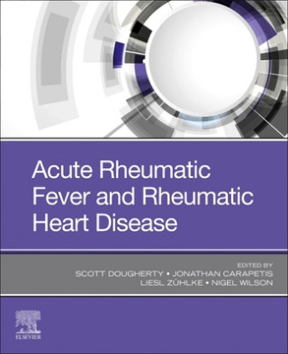 Kniha Acute Rheumatic Fever and Rheumatic Heart Disease Dr. Scott Dougherty