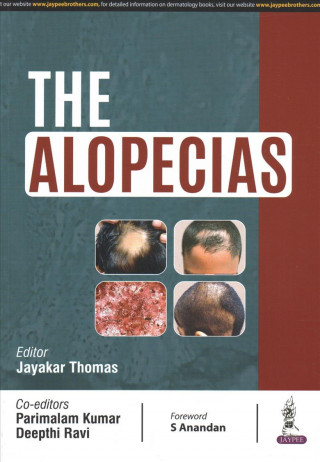 Knjiga Alopecias Jayakar Thomas