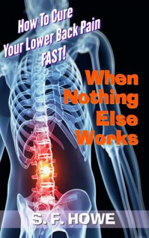 Carte When Nothing Else Works: How To Cure Your Lower Back Pain Fast! S F Howe