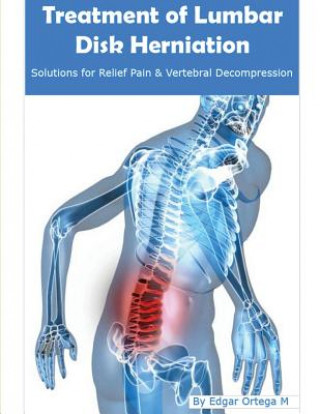 Книга Treatment of Lumbar Disk Herniation: Back Pain Relief and Herniated Discs Solutions Edgar Ortega Maldonado