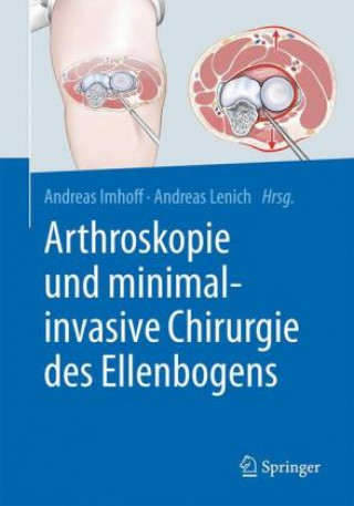 Kniha Arthroskopie und minimal-invasive Chirurgie des Ellenbogens Andreas B. Imhoff
