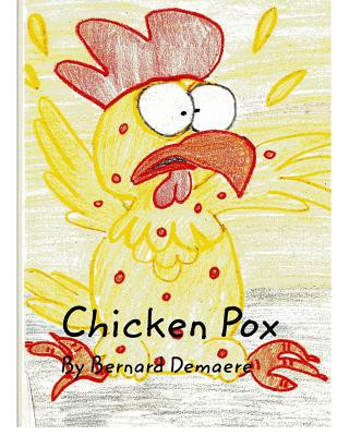 Kniha Chicken Pox BERNARD DEMAERE