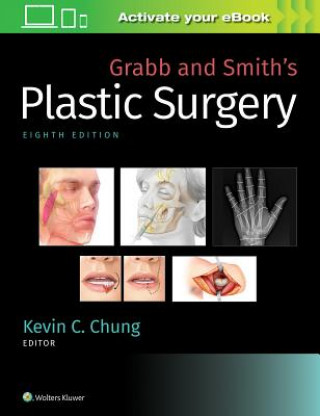 Kniha Grabb and Smith's Plastic Surgery Kevin Chung