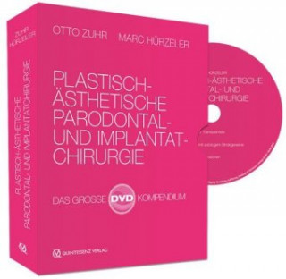 Видео Plastisch-Ästhetische Parodontal- und Implantatchirurgie Otto Zuhr
