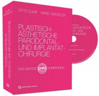 Wideo Plastisch-Ästhetische Parodontal- und Implantatchirurgie Otto Zuhr