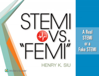 Carte STEMI vs. "FEMI" Siu