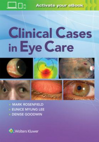 Book Clinical Cases in Eye Care Mark (Associate Professor Suny College of Optometry New York NY USA) Rosenfield