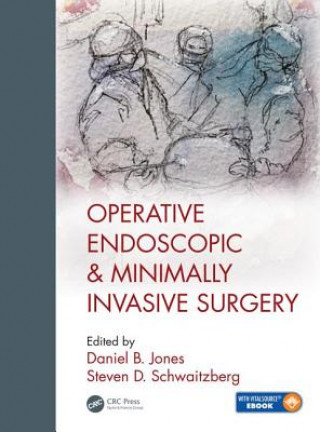 Carte Operative Endoscopic and Minimally Invasive Surgery Steven Schwaitzberg